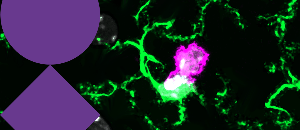 Save the date for Neuroimmunology&nbsp;2026!